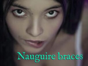 Nauguire_braces